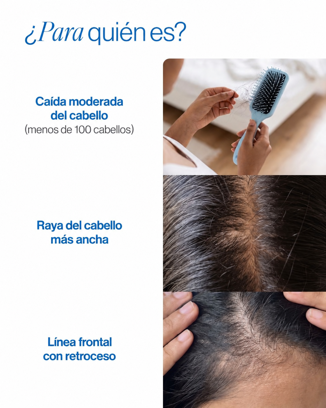 Sérum Capilar Roll-On | Crecimiento y Fortalecimiento del Cabello | 25 ml
