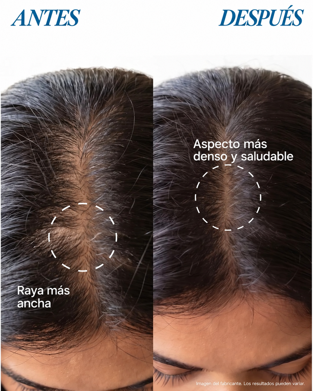Sérum Capilar Roll-On | Crecimiento y Fortalecimiento del Cabello | 25 ml