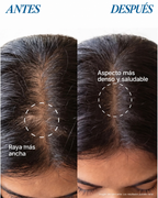 Sérum Capilar Roll-On | Crecimiento y Fortalecimiento del Cabello | 25 ml