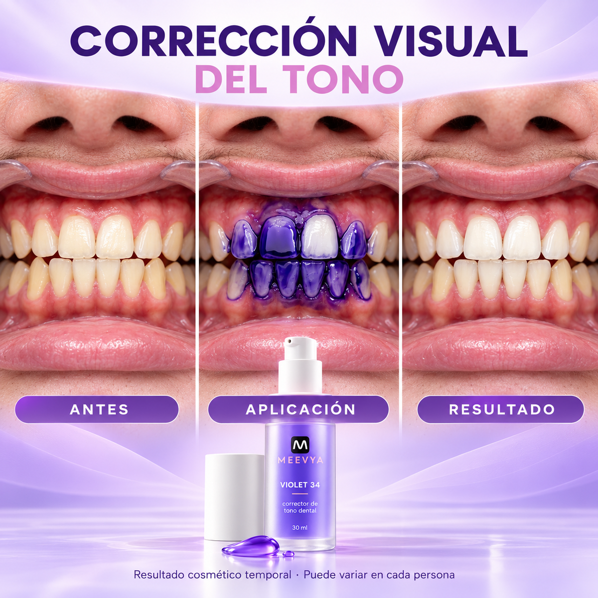 MEEVYA Violet 34™ – Sérum Corrector de Tono Dental, 30 ml